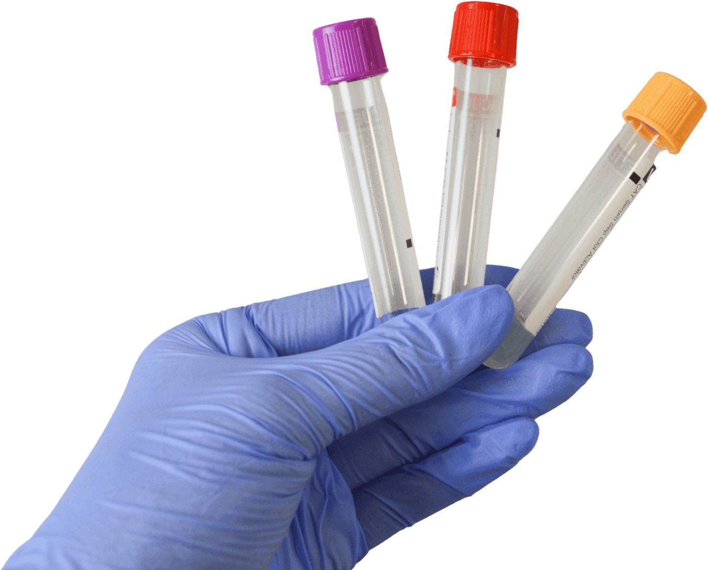 A phlebotomist with sample tubes
