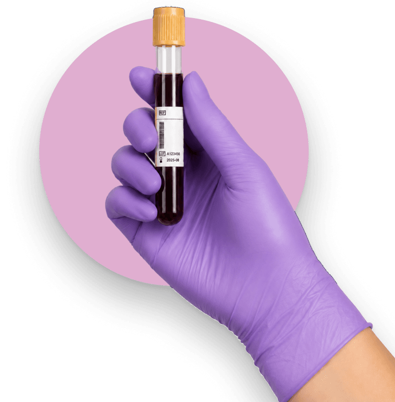 A gloved hand holding a blood sample